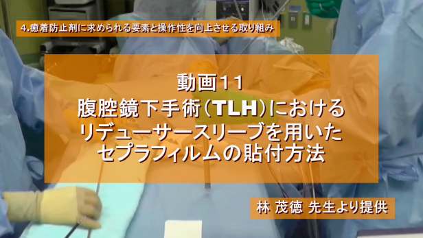 腹腔鏡下手術（TLH）におけるリデューサースリーブを用いたセプラフィルムの貼付方法
